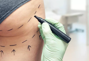 Duru gözəllikdən ifrat çirkinliyə: norma nədir?