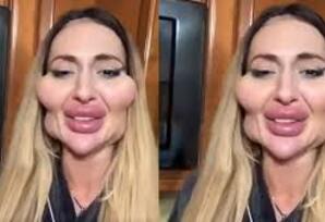 Sən ki çox gözəl idin?!