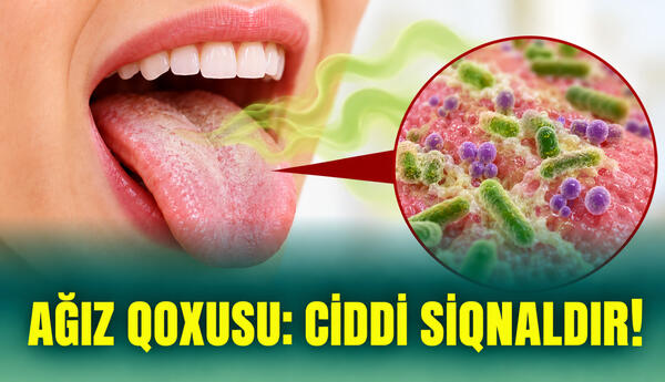 Ağız Qoxusu: Ciddi Siqnaldır